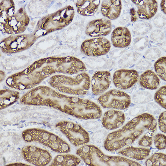 FBP1 Rabbit mAb