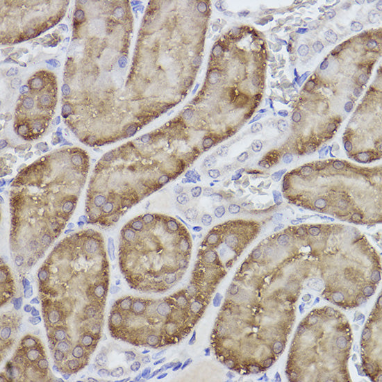 FBP1 Rabbit mAb