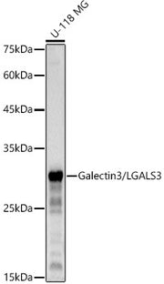 Galectin 3/LGALS3 Rabbit mAb