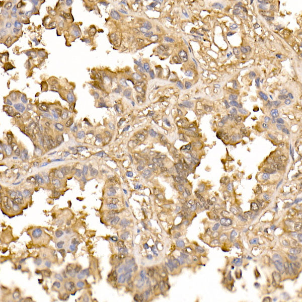 Galectin 3/LGALS3 Rabbit mAb