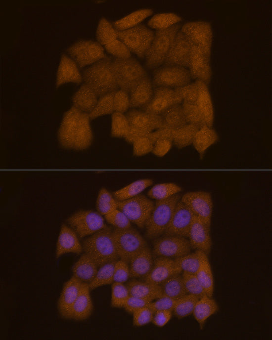 Galectin 3/LGALS3 Rabbit mAb