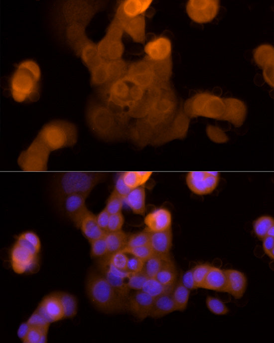 Galectin 3/LGALS3 Rabbit mAb