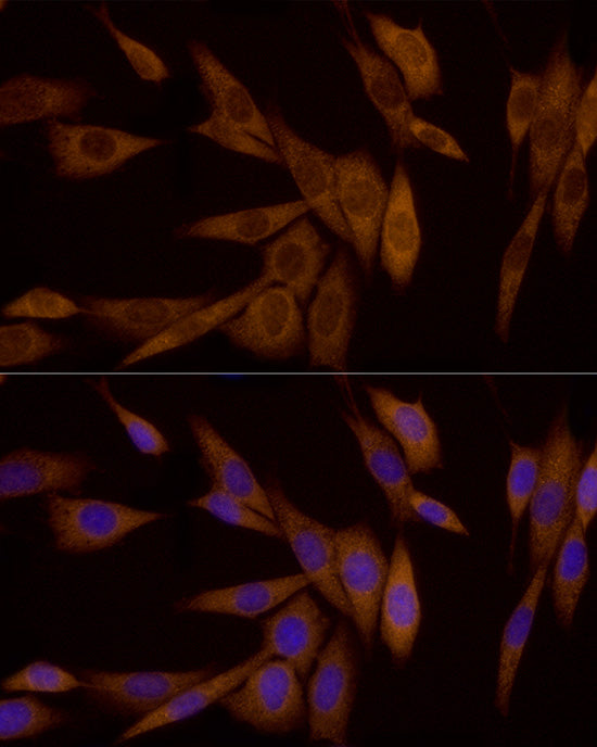Galectin 3/LGALS3 Rabbit mAb