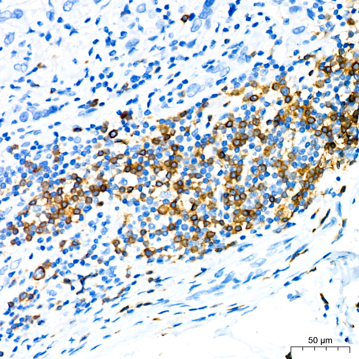 CD79a Rabbit mAb