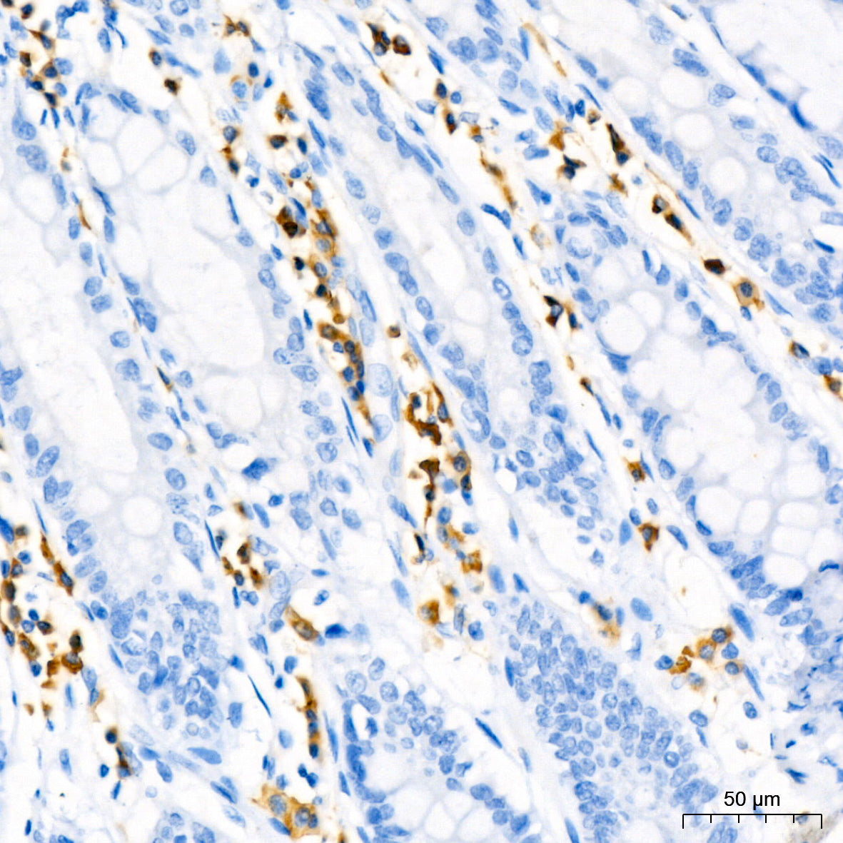 CD79a Rabbit mAb
