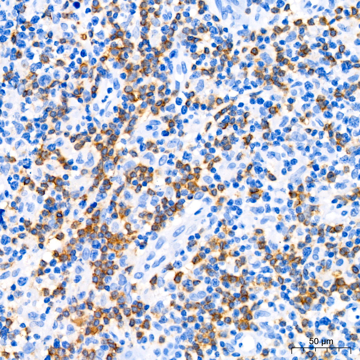 CD79a Rabbit mAb
