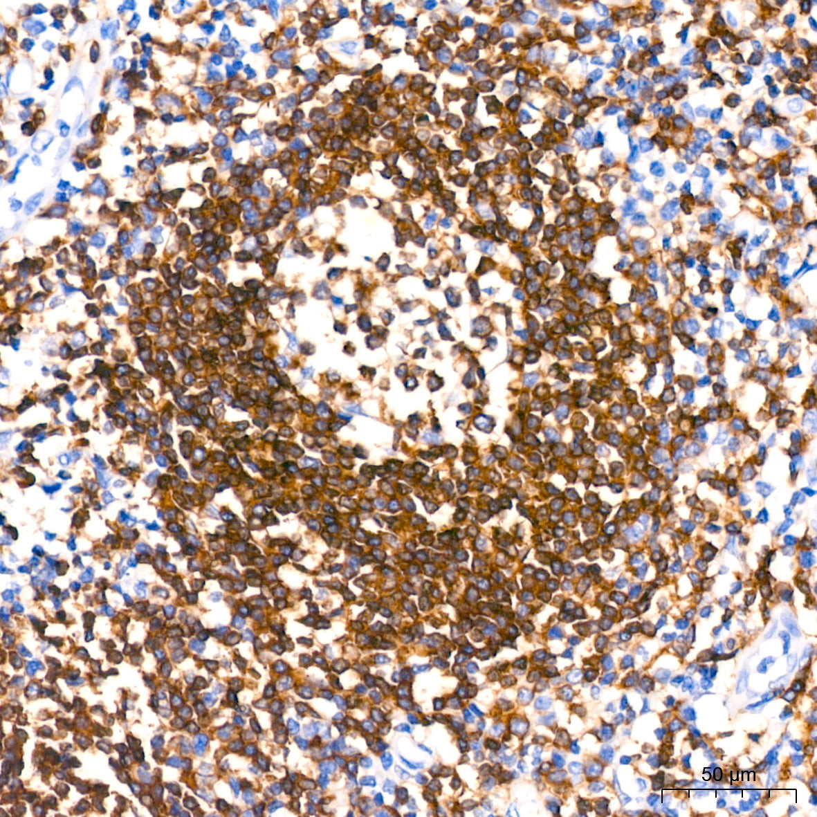 CD79a Rabbit mAb
