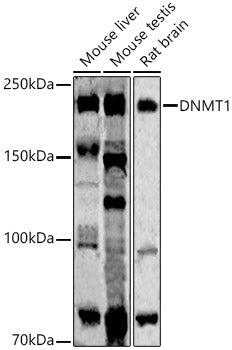 DNMT1 Rabbit mAb