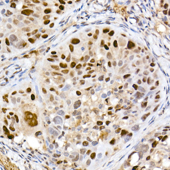 DNMT1 Rabbit mAb