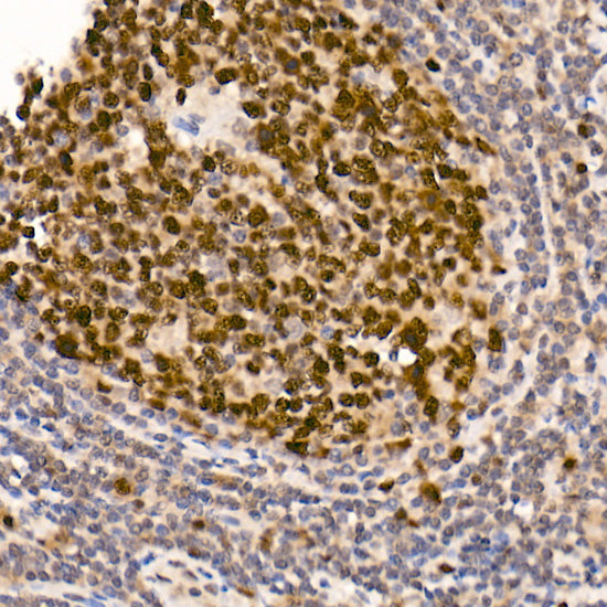 DNMT1 Rabbit mAb