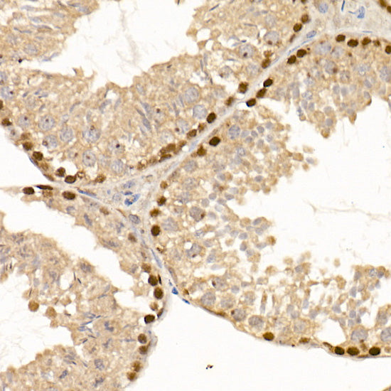 DNMT1 Rabbit mAb