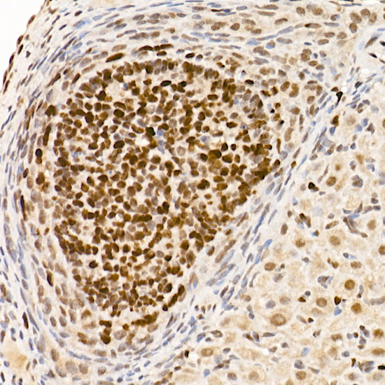 DNMT1 Rabbit mAb