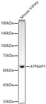 ATP6AP1 Rabbit mAb
