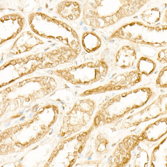 ATP6AP1 Rabbit mAb