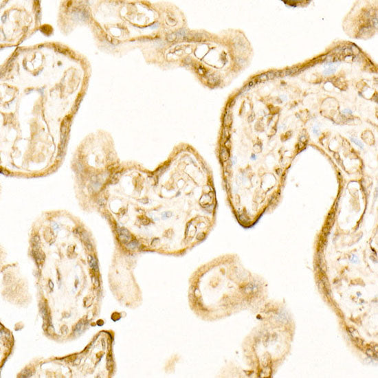 ATP6AP1 Rabbit mAb