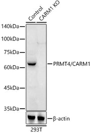 [KO Validated] PRMT4/CARM1 Rabbit pAb