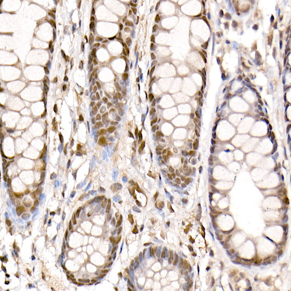 [KO Validated] PRMT4/CARM1 Rabbit pAb