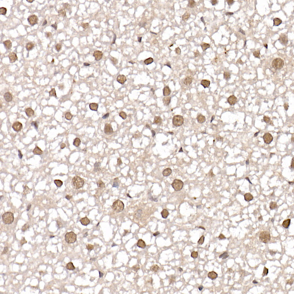 [KO Validated] PRMT4/CARM1 Rabbit pAb