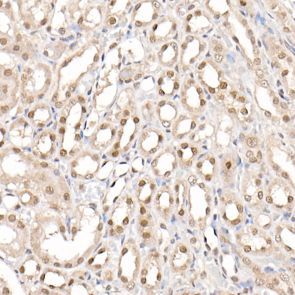 [KO Validated] PRMT4/CARM1 Rabbit pAb