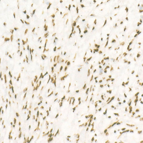 CDK12 Rabbit mAb