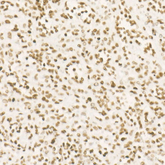 CDK12 Rabbit mAb