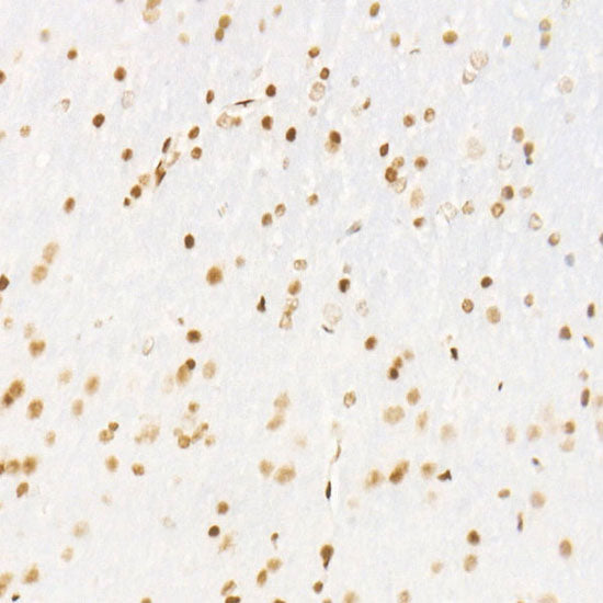 CDK12 Rabbit mAb