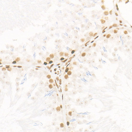 CDK12 Rabbit mAb