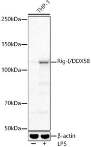 Rig-I/DDX58 Rabbit mAb