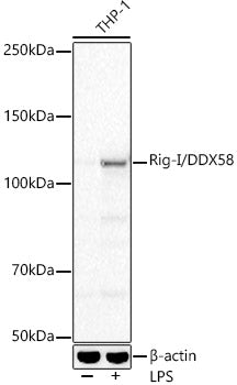 Rig-I/DDX58 Rabbit mAb
