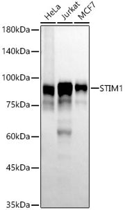 STIM1 Rabbit mAb