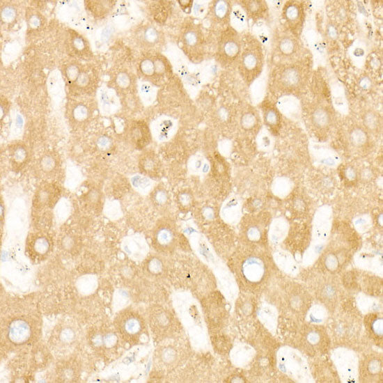 STIM1 Rabbit mAb