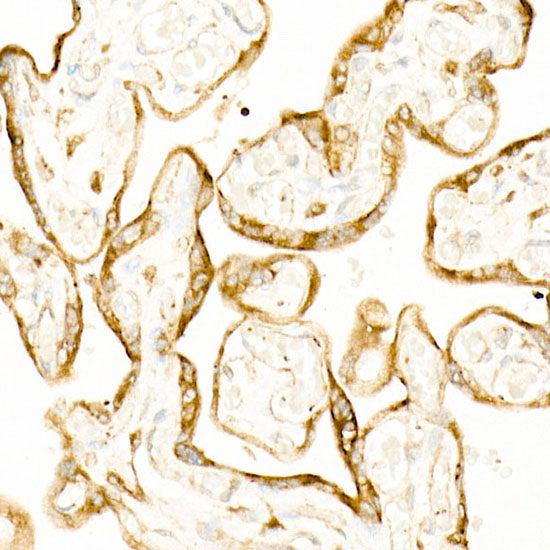 STIM1 Rabbit mAb