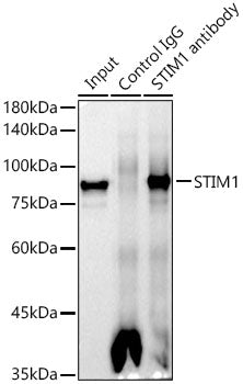 STIM1 Rabbit mAb