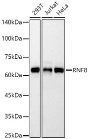 RNF8 Rabbit mAb