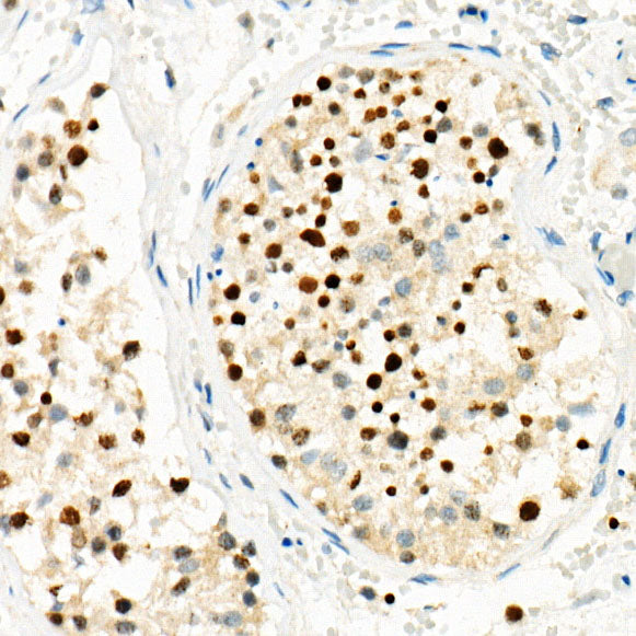 RNF8 Rabbit mAb