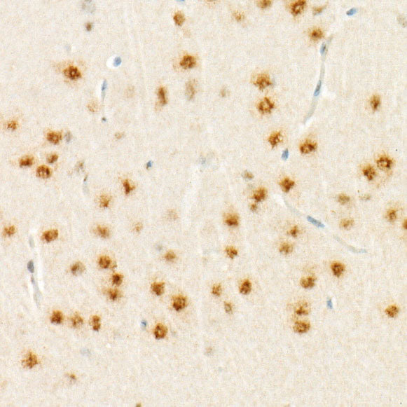 RNF8 Rabbit mAb