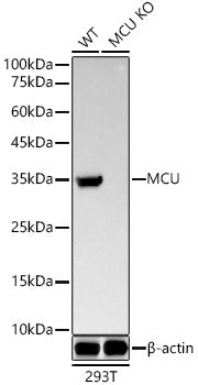 [KO Validated] MCU Rabbit mAb