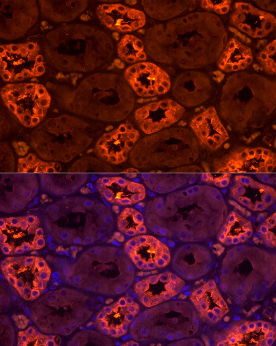 Tamm Horsfall Glycoprotein Rabbit pAb