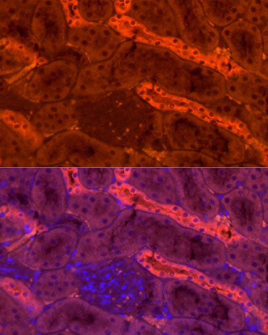 Tamm Horsfall Glycoprotein Rabbit pAb