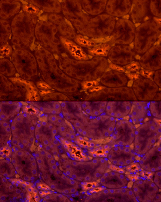 Tamm Horsfall Glycoprotein Rabbit pAb