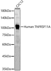 Human TNFRSF11A Rabbit pAb