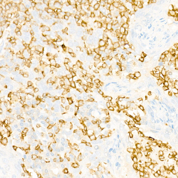 IL23R Rabbit mAb