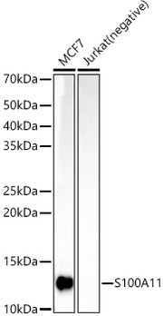 S100A11 Rabbit mAb