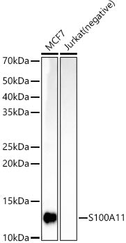 S100A11 Rabbit mAb