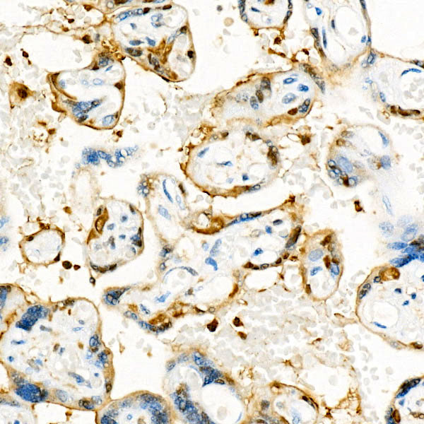 S100A11 Rabbit mAb