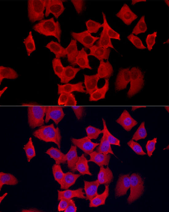 S100A11 Rabbit mAb
