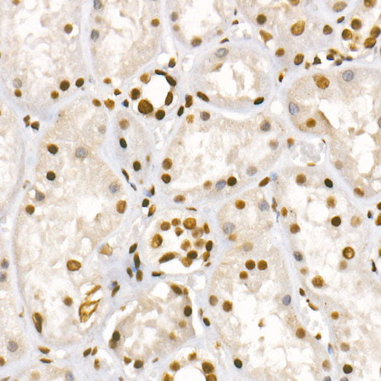 Acetyl-Histone H3-K56 Rabbit mAb