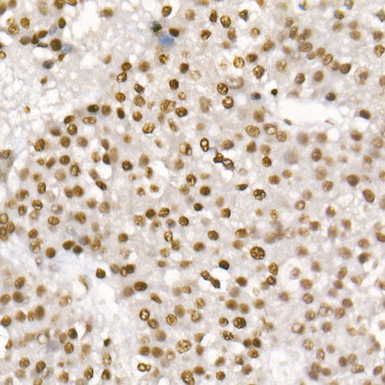 Acetyl-Histone H3-K56 Rabbit mAb