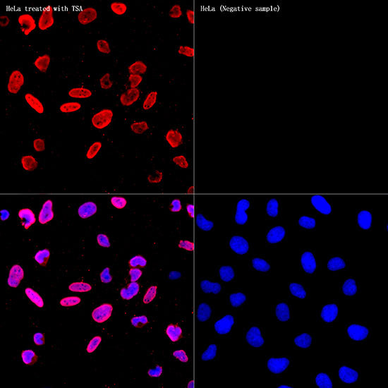 Acetyl-Histone H3-K56 Rabbit mAb