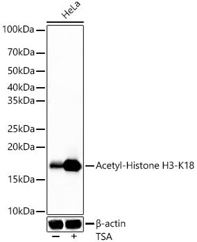 Acetyl-Histone H3-K18 Rabbit mAb